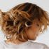 Exosomas y la evolución en el tratamiento de la caída del cabello